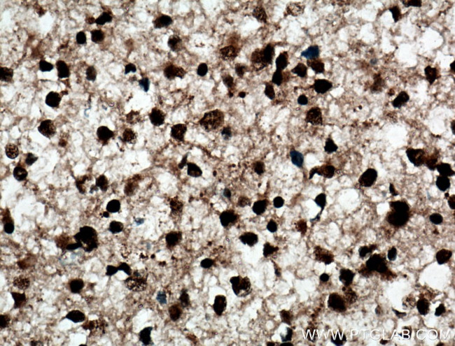 ADAR1 Antibody in Immunohistochemistry (Paraffin) (IHC (P))