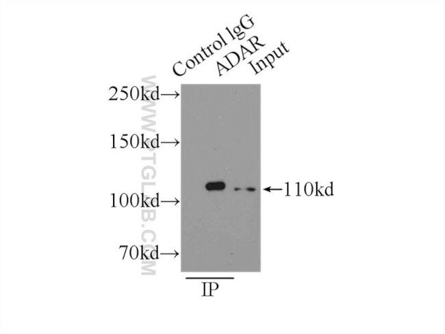 ADAR1 Antibody in Immunoprecipitation (IP)