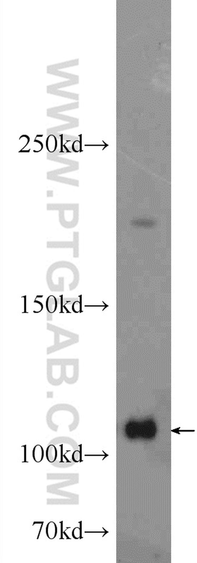 ADAR1 Antibody in Western Blot (WB)