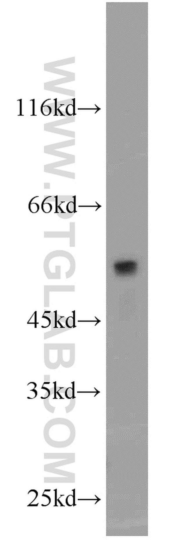 CADM1 Antibody in Western Blot (WB)