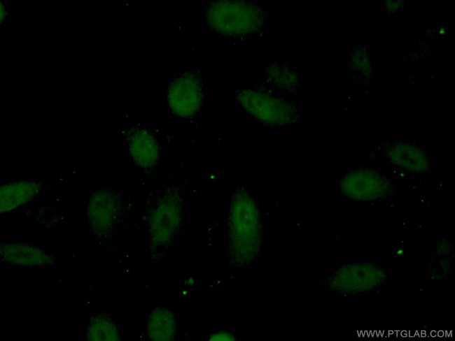 HLX Antibody in Immunocytochemistry (ICC/IF)