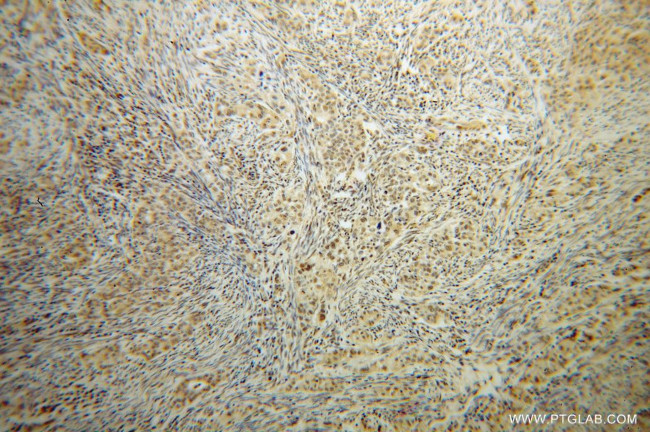 HLX Antibody in Immunohistochemistry (Paraffin) (IHC (P))