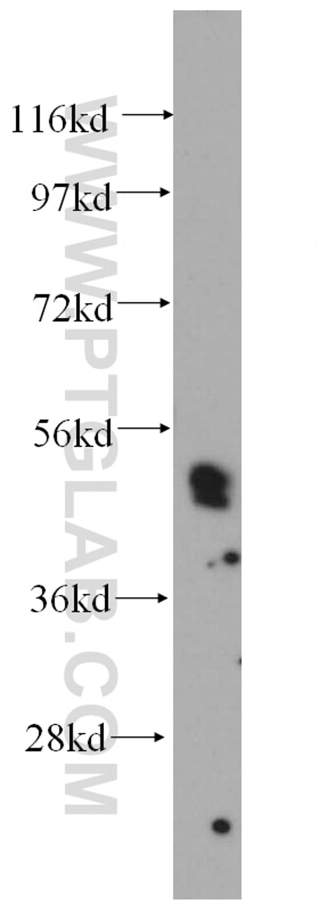 HLX Antibody in Western Blot (WB)