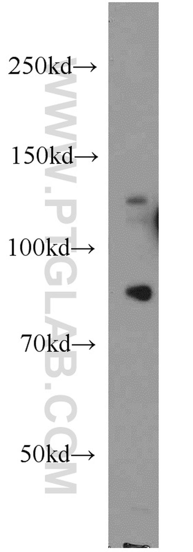 PALB2 Antibody in Western Blot (WB)