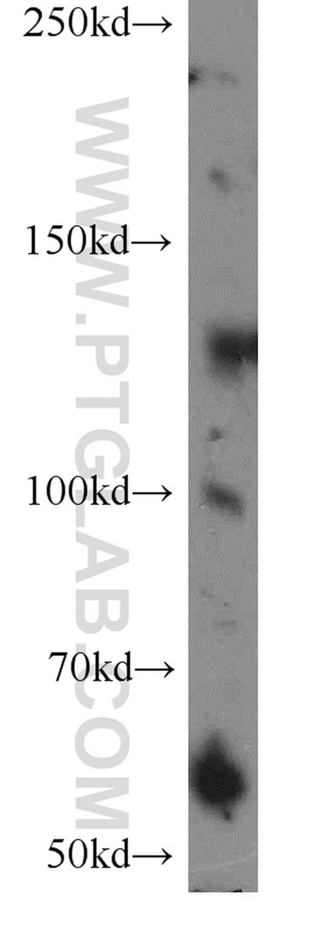 PALB2 Antibody in Western Blot (WB)