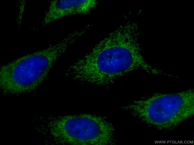 MAVS/VISA Antibody in Immunocytochemistry (ICC/IF)