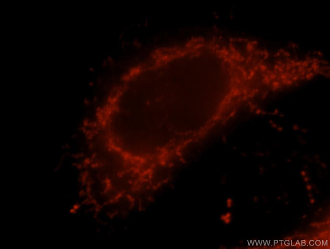 MAVS/VISA Antibody in Immunocytochemistry (ICC/IF)