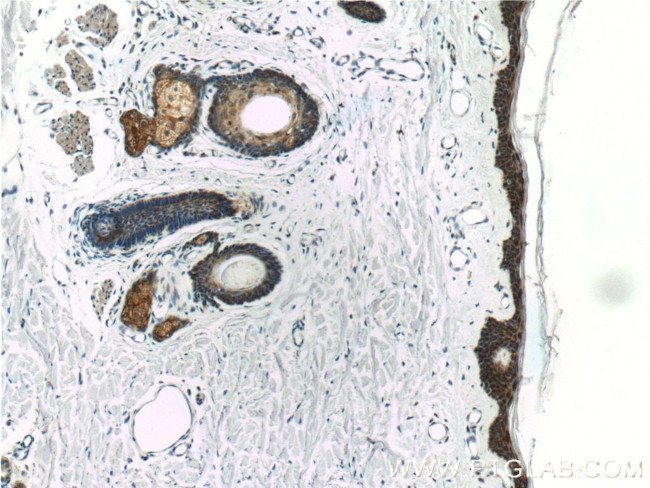 MAVS/VISA Antibody in Immunohistochemistry (Paraffin) (IHC (P))