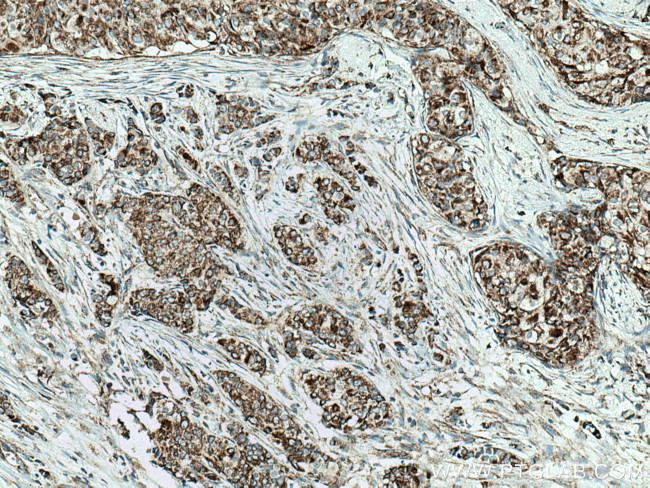 MAVS/VISA Antibody in Immunohistochemistry (Paraffin) (IHC (P))