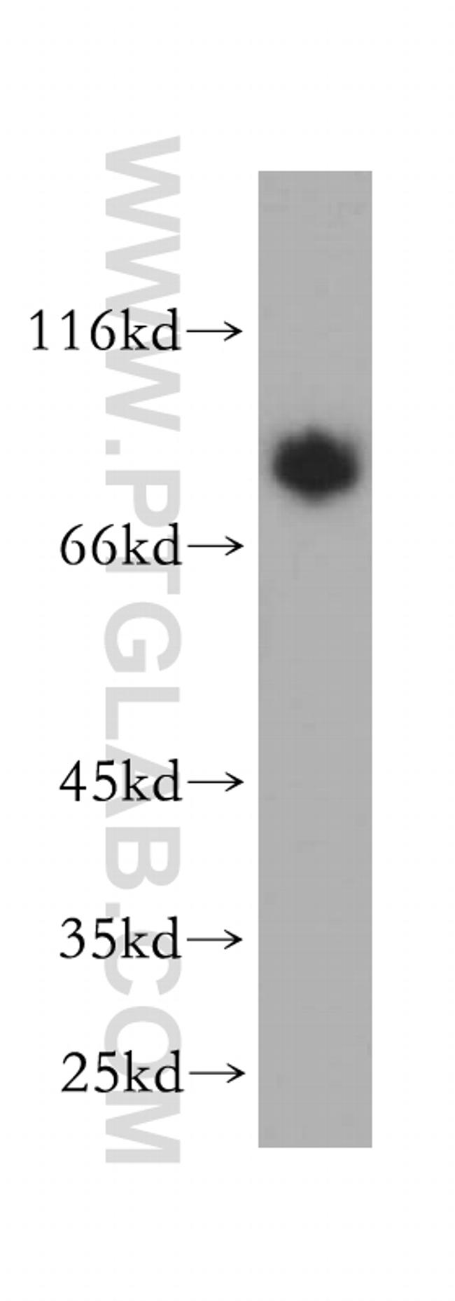 MAVS/VISA Antibody in Western Blot (WB)