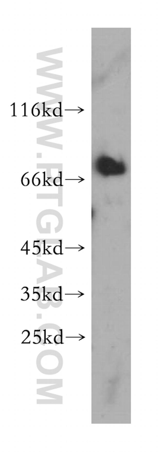 MAVS/VISA Antibody in Western Blot (WB)