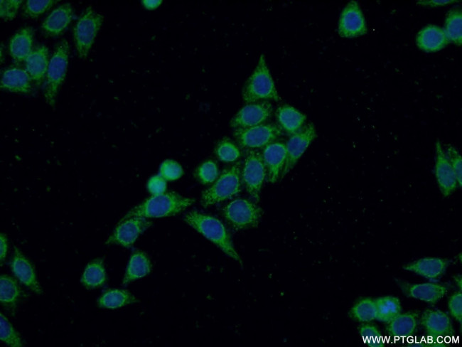 DIAPH3 Antibody in Immunocytochemistry (ICC/IF)