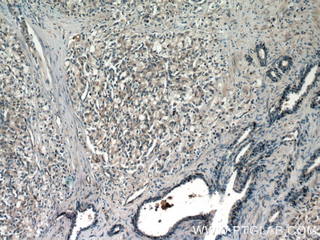 DIAPH3 Antibody in Immunohistochemistry (Paraffin) (IHC (P))