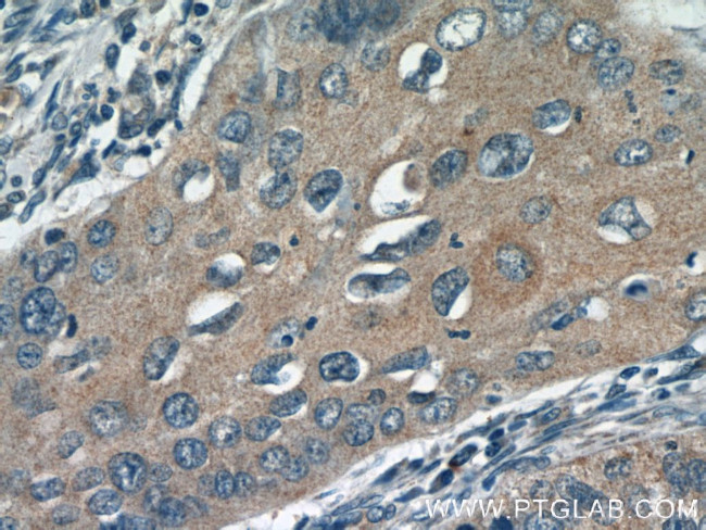 DIAPH3 Antibody in Immunohistochemistry (Paraffin) (IHC (P))