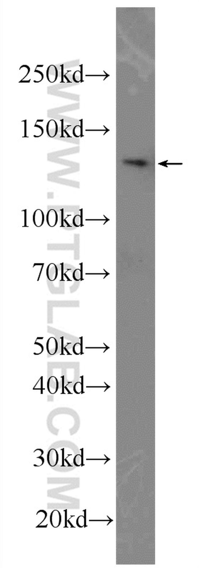 DIAPH3 Antibody in Western Blot (WB)