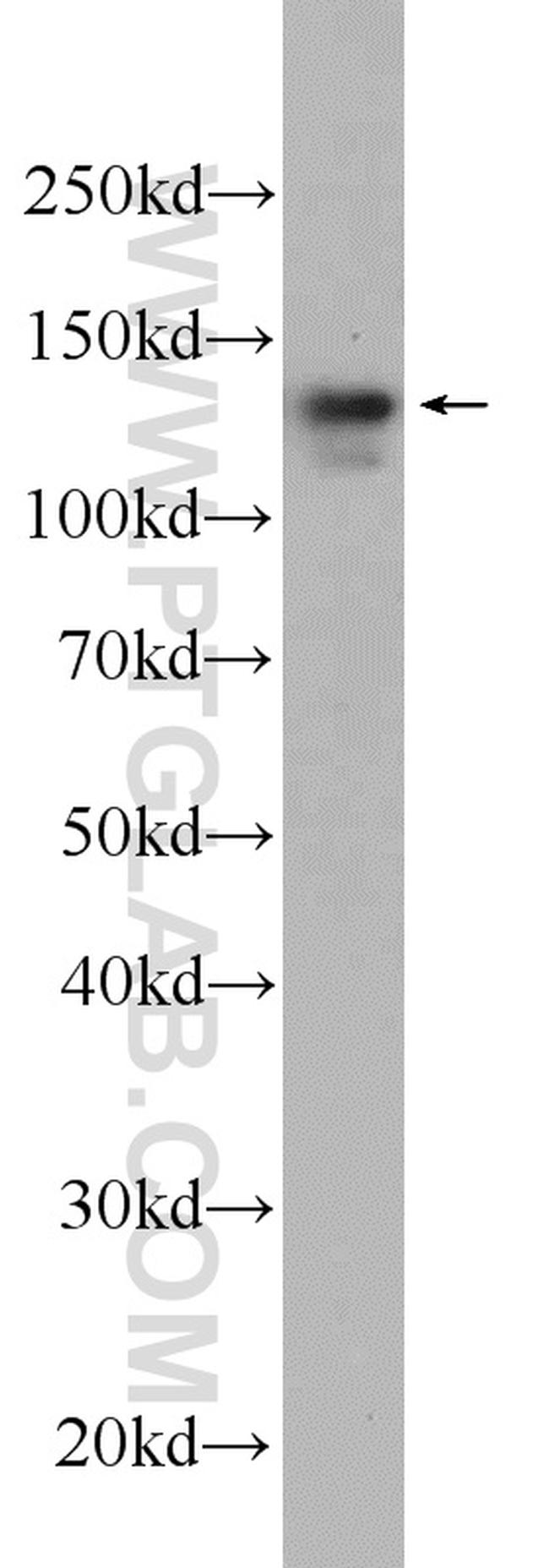 DIAPH3 Antibody in Western Blot (WB)