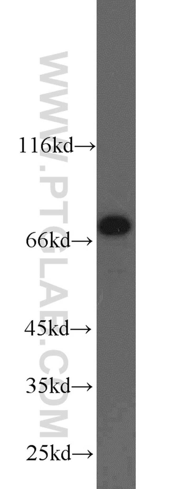 NUB1 Antibody in Western Blot (WB)