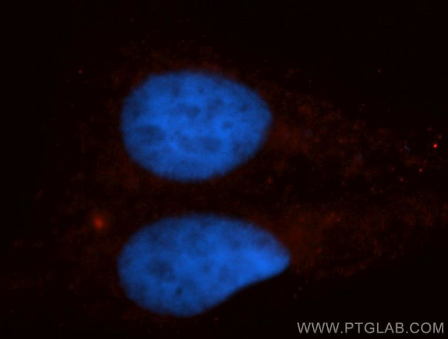 KIF4A Antibody in Immunocytochemistry (ICC/IF)