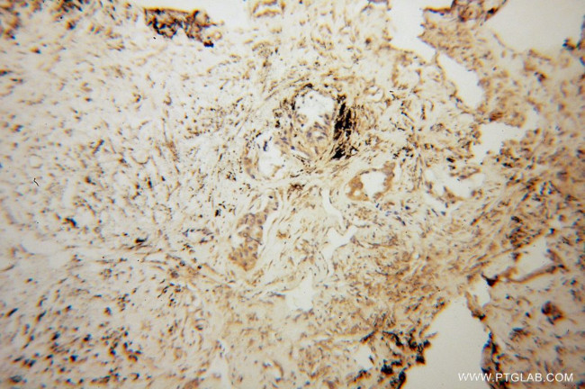 KIF4A Antibody in Immunohistochemistry (Paraffin) (IHC (P))