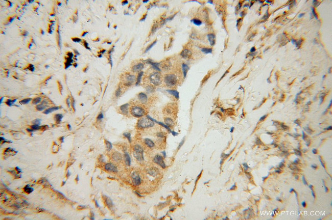 KIF4A Antibody in Immunohistochemistry (Paraffin) (IHC (P))