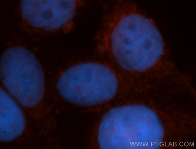 VBP1 Antibody in Immunocytochemistry (ICC/IF)