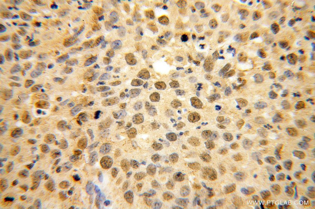 USP1 Antibody in Immunohistochemistry (Paraffin) (IHC (P))