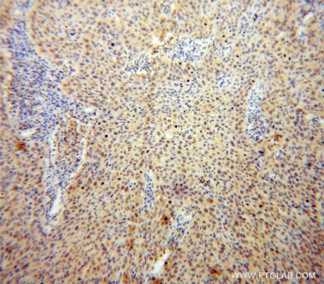 USP1 Antibody in Immunohistochemistry (Paraffin) (IHC (P))