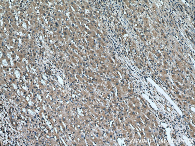 USP1 Antibody in Immunohistochemistry (Paraffin) (IHC (P))