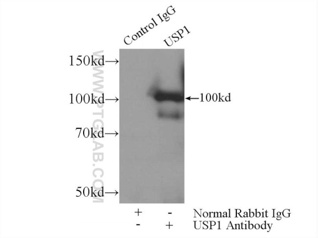 USP1 Antibody in Immunoprecipitation (IP)