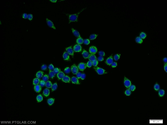 NOX4 Antibody in Immunocytochemistry (ICC/IF)