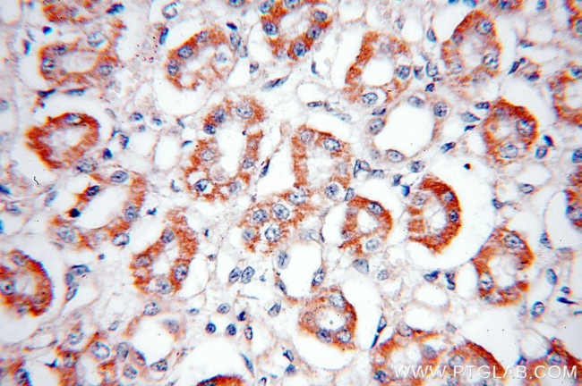 NOX4 Antibody in Immunohistochemistry (Paraffin) (IHC (P))