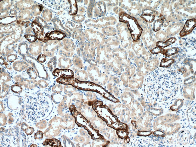 NOX4 Antibody in Immunohistochemistry (Paraffin) (IHC (P))