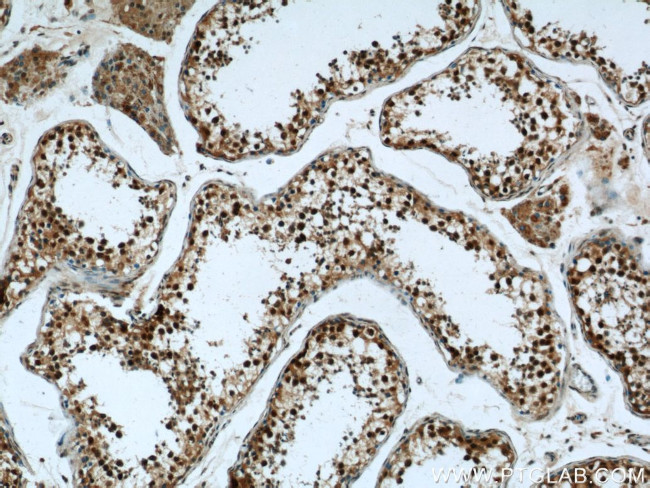 CRCP Antibody in Immunohistochemistry (Paraffin) (IHC (P))