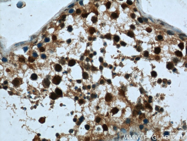 CRCP Antibody in Immunohistochemistry (Paraffin) (IHC (P))