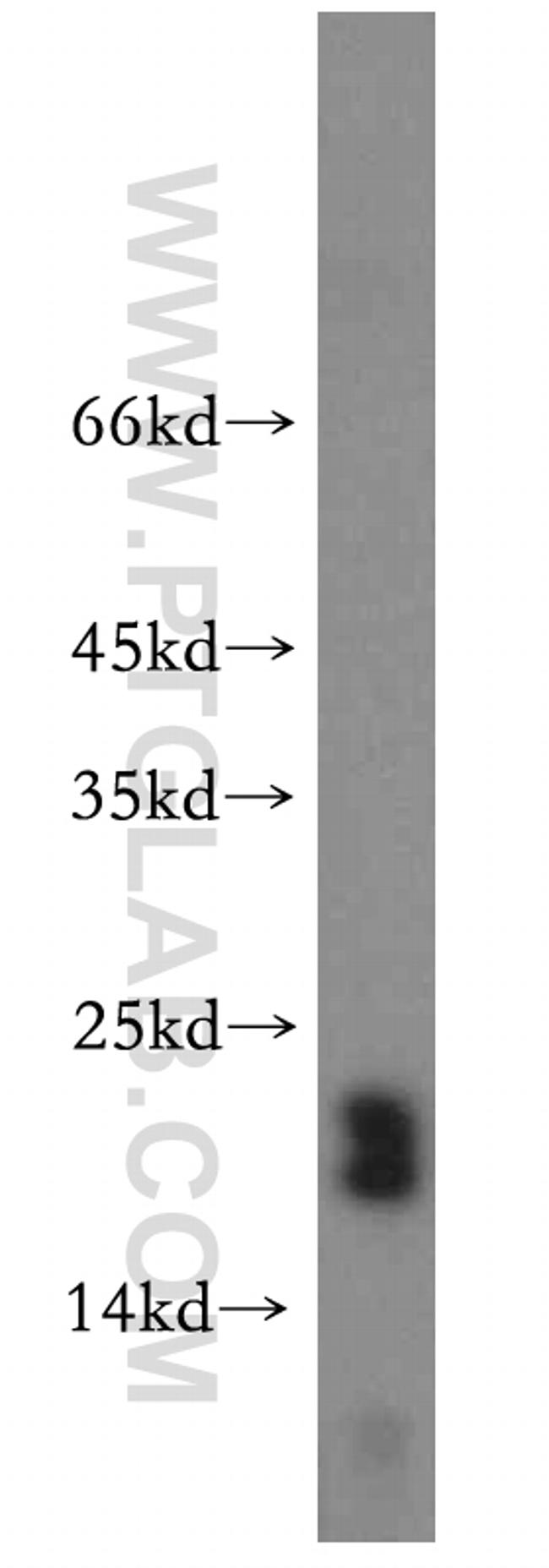 CRCP Antibody in Western Blot (WB)