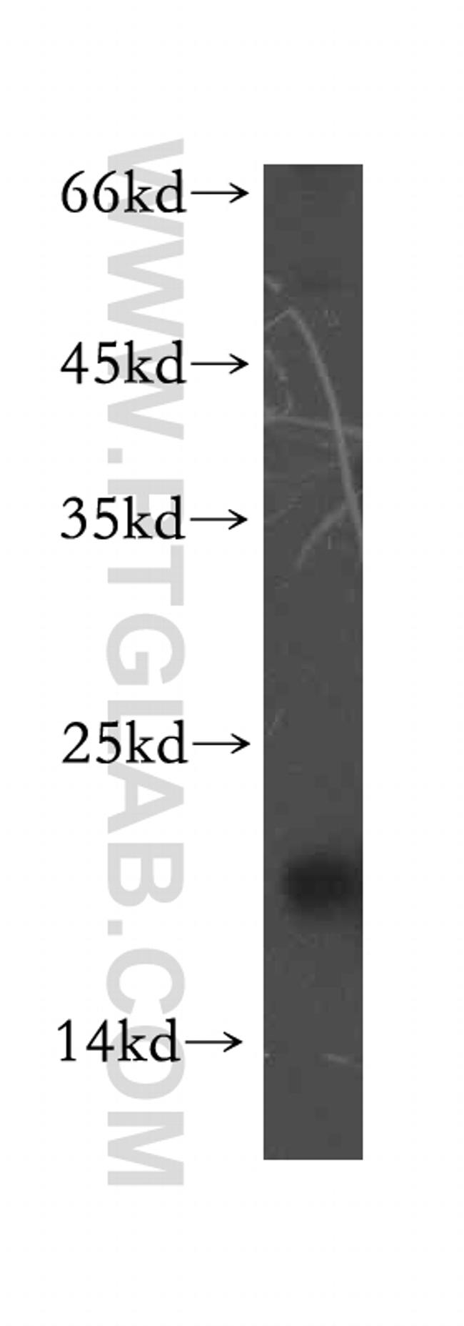 CRCP Antibody in Western Blot (WB)