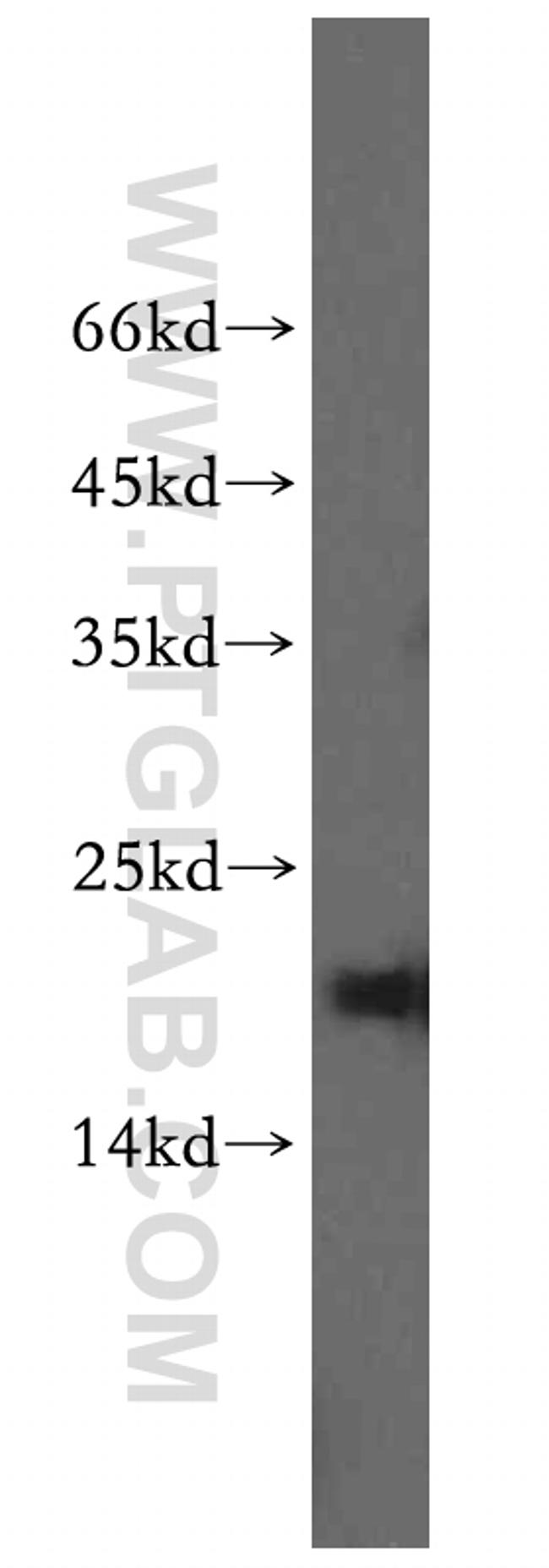 CRCP Antibody in Western Blot (WB)