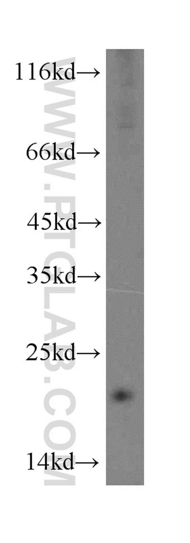 CRCP Antibody in Western Blot (WB)