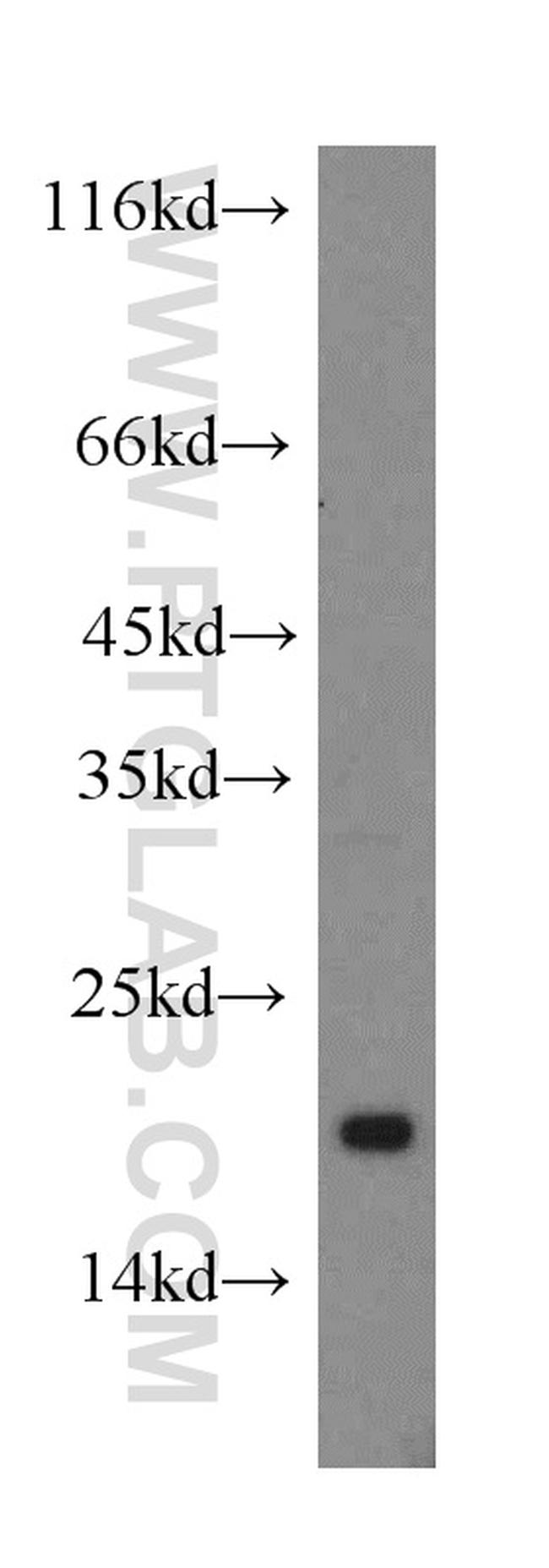 CRCP Antibody in Western Blot (WB)