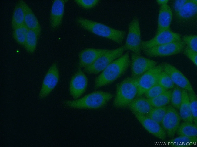 RABEP1 Antibody in Immunocytochemistry (ICC/IF)