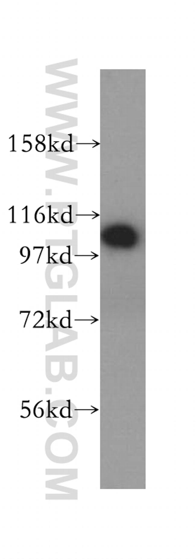RABEP1 Antibody in Western Blot (WB)