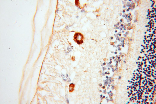 RBP3 Antibody in Immunohistochemistry (Paraffin) (IHC (P))