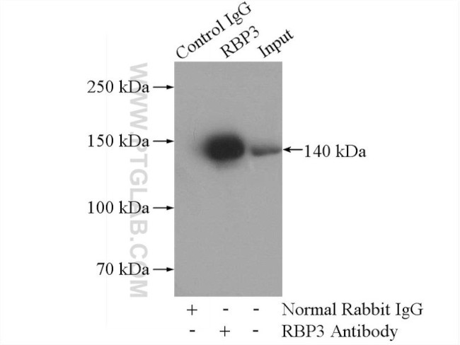 RBP3 Antibody in Immunoprecipitation (IP)