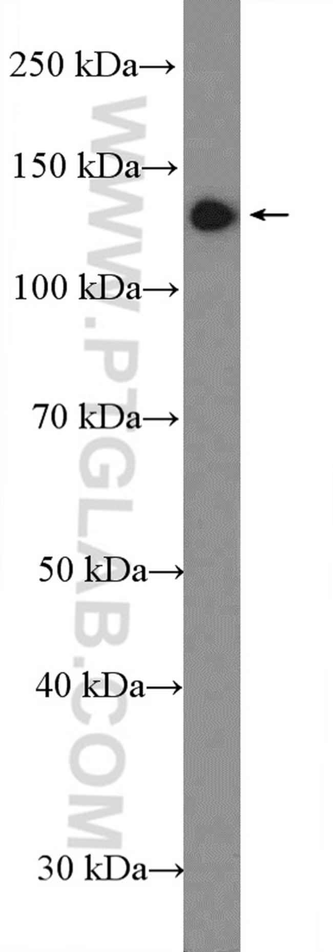 RBP3 Antibody in Western Blot (WB)