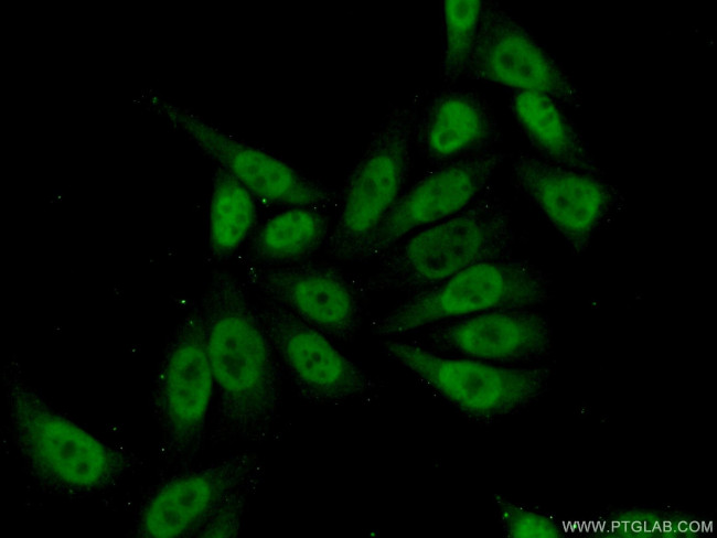 MEF2D Antibody in Immunocytochemistry (ICC/IF)