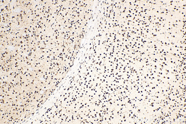 MEF2D Antibody in Immunohistochemistry (Paraffin) (IHC (P))