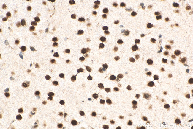 MEF2D Antibody in Immunohistochemistry (Paraffin) (IHC (P))