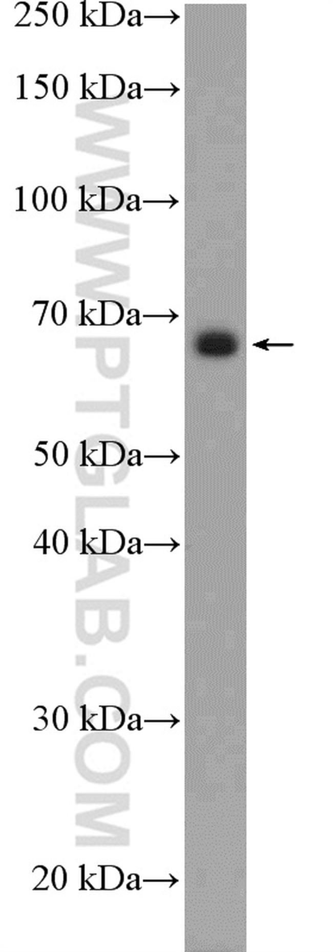 MEF2D Antibody in Western Blot (WB)