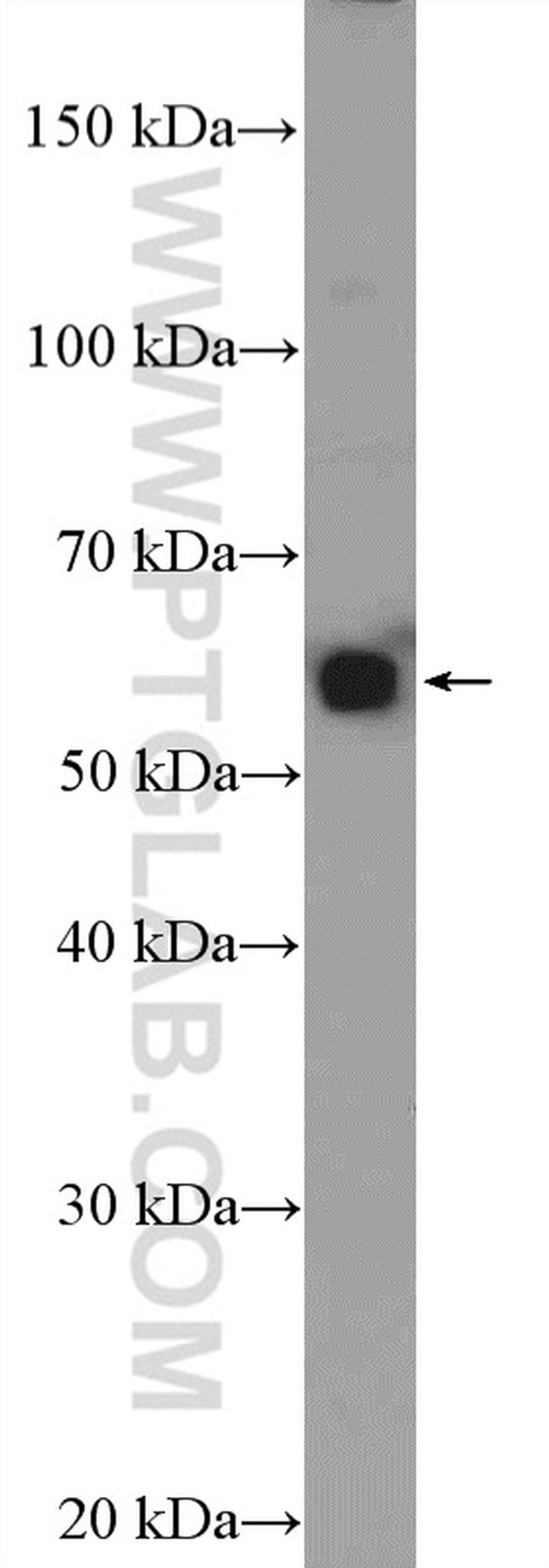 MEF2D Antibody in Western Blot (WB)