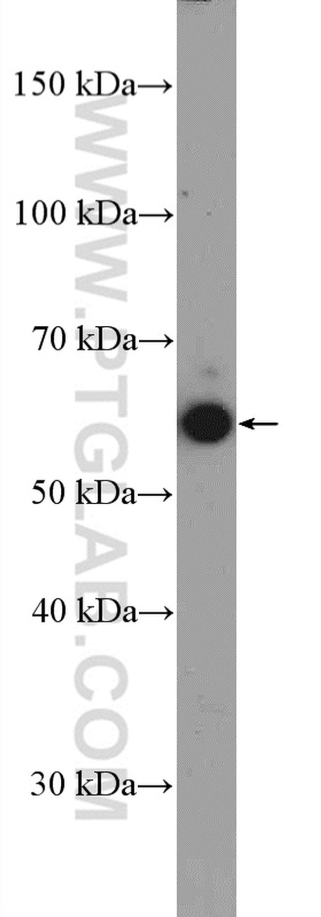 MEF2D Antibody in Western Blot (WB)